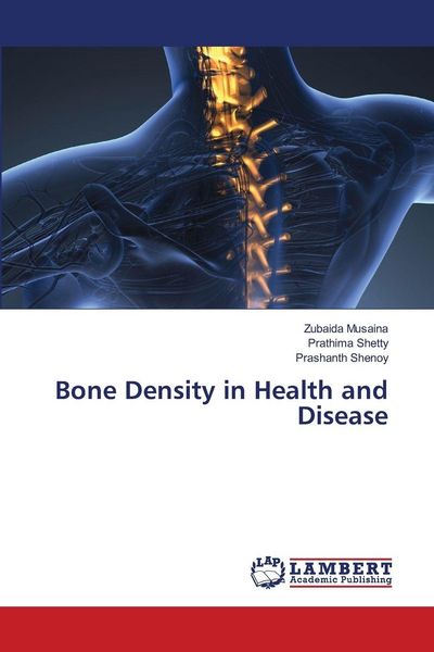 Produktbild: Bone Density in Health and Disease