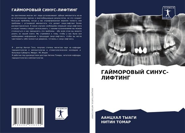 Produktbild: Gajmorovyj Sinus-Lifting