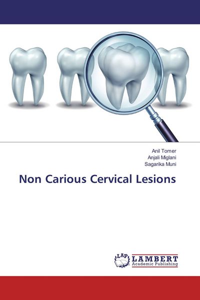 Produktbild: Non Carious Cervical Lesions