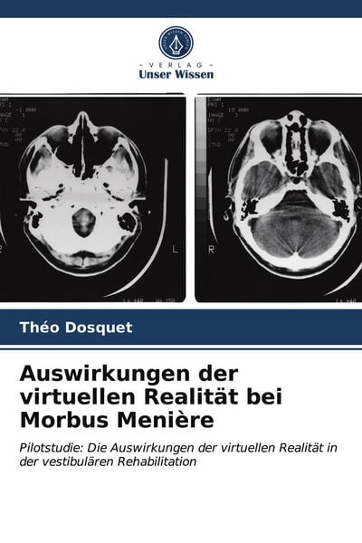 Auswirkungen der virtuellen Realität bei Morbus Menière, Taschenbuch von Théo Dosquet, Verlag Unser Wissen, 9786203978438