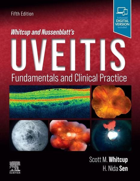 Produktbild: Whitcup and Nussenblatt's Uveitis