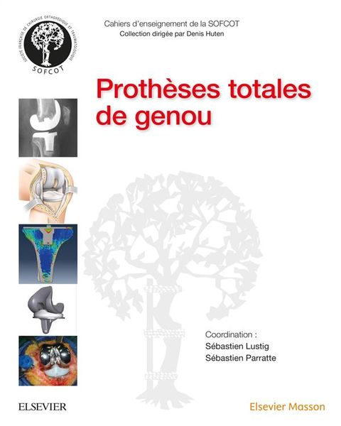 Produktbild: Proth&egrave;ses totales du genou