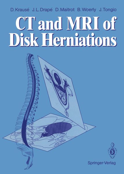 Produktbild: CT and MRI of Disk Herniations