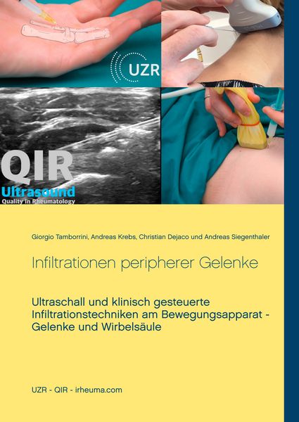 Produktbild: Infiltrationen peripherer Gelenke