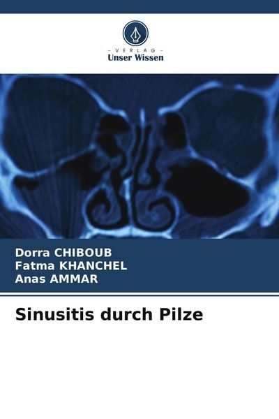 Produktbild: Sinusitis durch Pilze