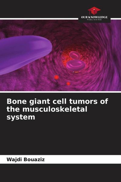 Produktbild: Bone giant cell tumors of the musculoskeletal system