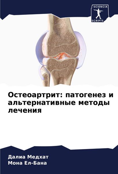 Produktbild: Osteoartrit: patogenez i al'ternatiwnye metody lecheniq