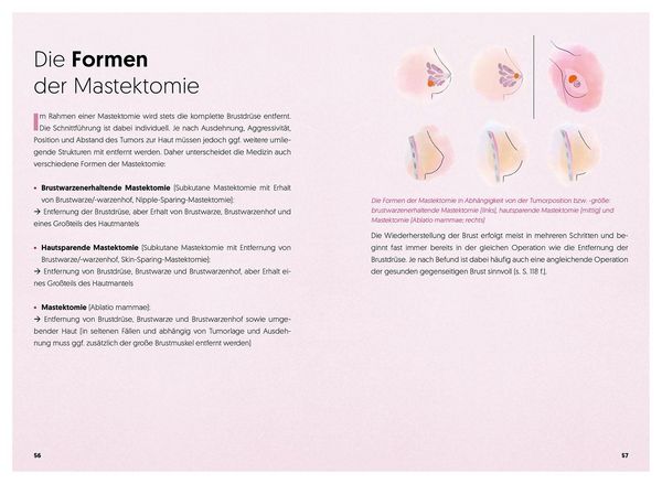Produktbild: Diagnose Brustkrebs