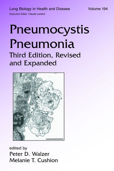 Produktbild: Pneumocystis Pneumonia