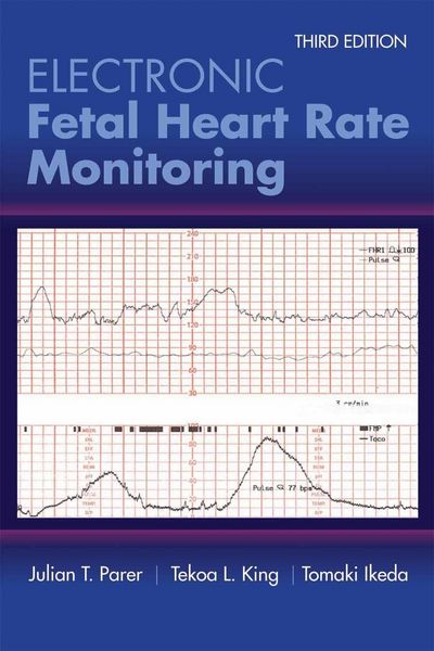 Produktbild: Electronic Fetal Heart Rate Monitoring: The 5-Tier System