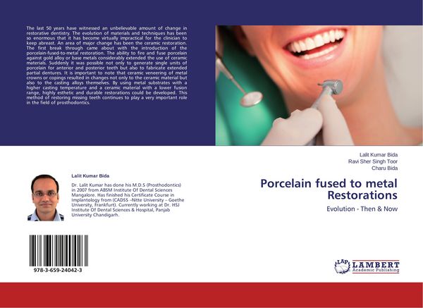Produktbild: Porcelain fused to metal Restorations