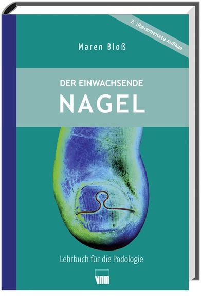 Der einwachsende Nagel