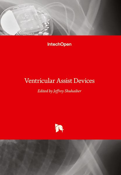 Produktbild: Ventricular Assist Devices