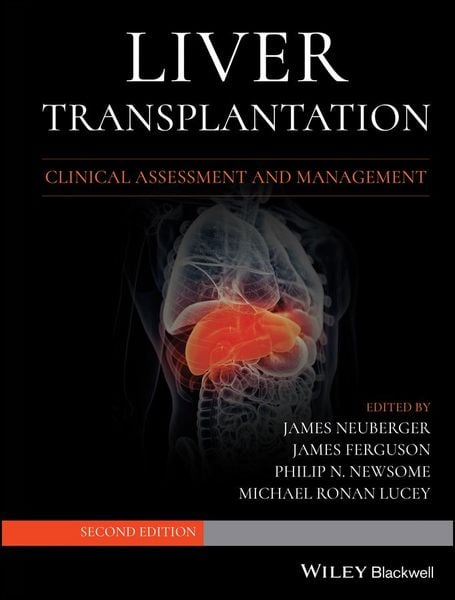 Produktbild: Liver Transplantation