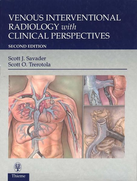 Produktbild: Venous Interventional Radiology With Clinical Perspectives