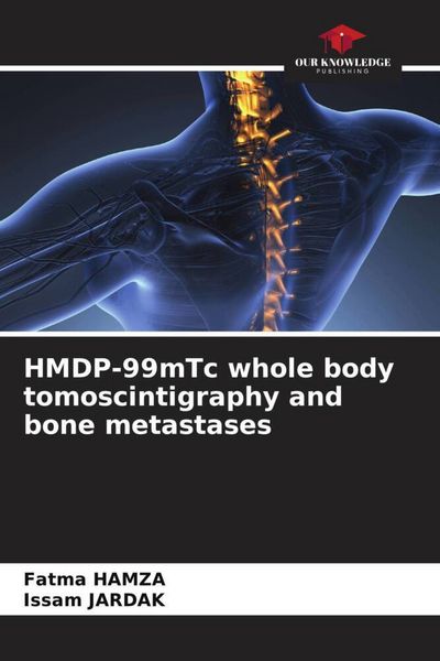Produktbild: HMDP-99mTc whole body tomoscintigraphy and bone metastases