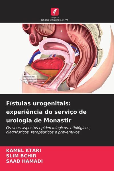 Produktbild: F&iacute;stulas urogenitais: experi&ecirc;ncia do servi&ccedil;o de urologia de Monastir