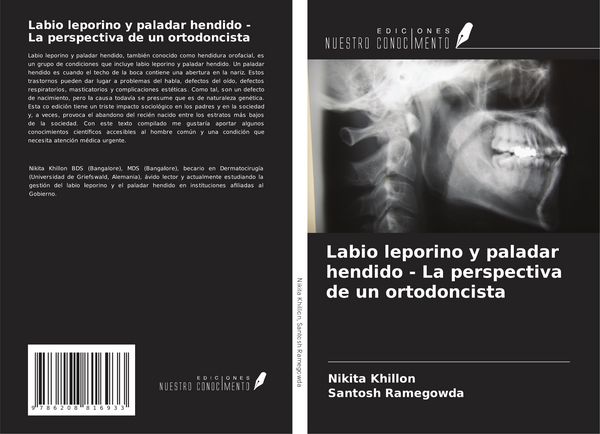 Produktbild: Labio leporino y paladar hendido - La perspectiva de un ortodoncista