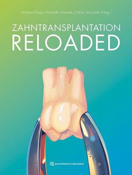 Produktbild: Zahntransplantation Reloaded