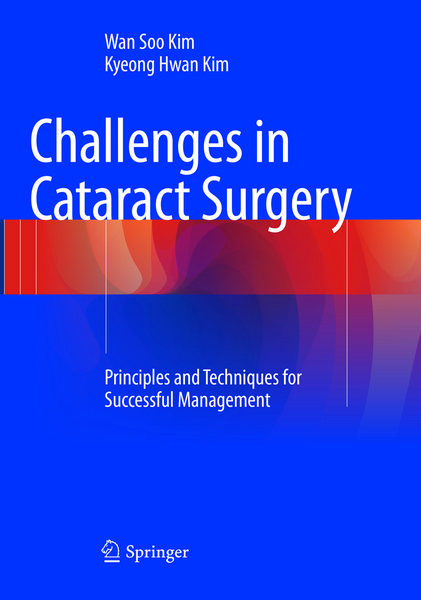 Produktbild: Challenges in Cataract Surgery
