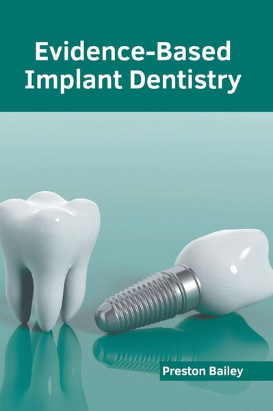 Produktbild: Evidence-Based Implant Dentistry