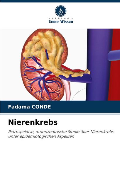 Nierenkrebs, Taschenbuch von Fadama Conde, Verlag Unser Wissen, 9786202002950