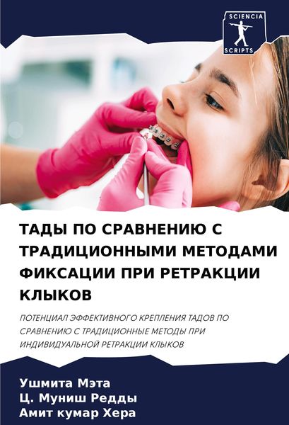 Produktbild: Tady Po Sravneniju S Tradicionnymi Metodami Fiksacii Pri Retrakcii Klykov