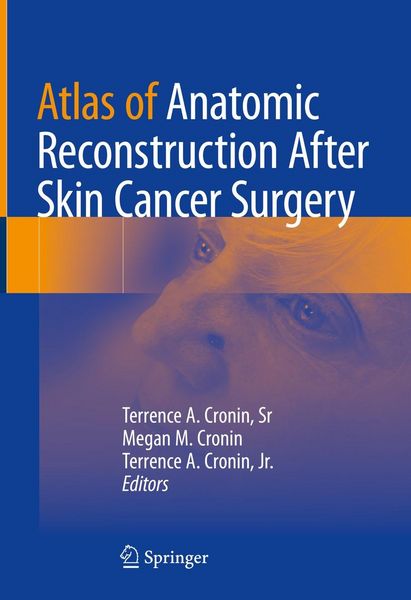 Produktbild: Atlas of Anatomic Reconstruction After Skin Cancer Surgery