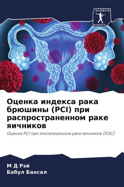Produktbild: Ocenka indexa raka br&uuml;shiny (PCI) pri rasprostranennom rake qichnikow