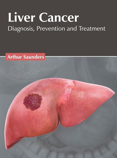 Produktbild: Liver Cancer: Diagnosis, Prevention and Treatment