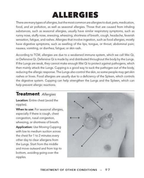 Produktbild: Cupping Therapy for Muscles and Joints