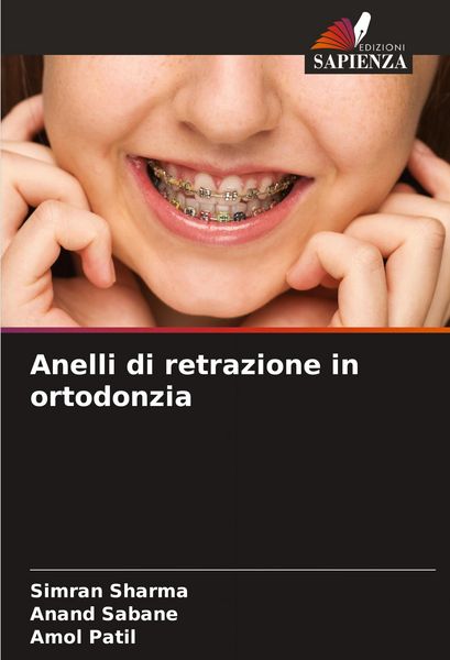 Produktbild: Anelli di retrazione in ortodonzia