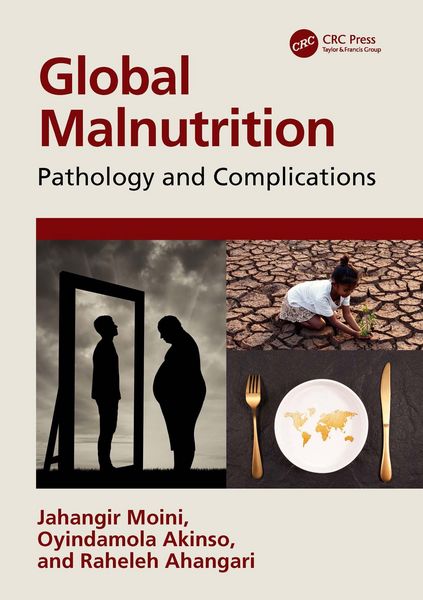 Produktbild: Global Malnutrition
