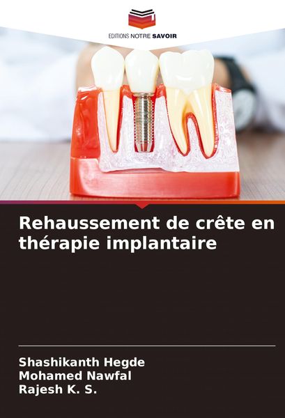 Produktbild: Rehaussement de cr&ecirc;te en th&eacute;rapie implantaire