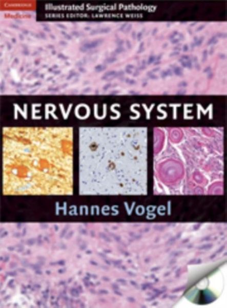 Produktbild: Nervous System