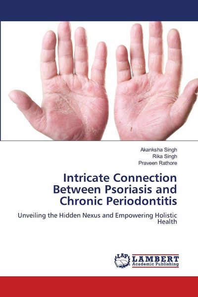 Produktbild: Intricate Connection Between Psoriasis and Chronic Periodontitis
