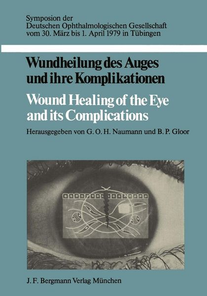 Produktbild: Wundheilung des Auges und ihre Komplikationen / Wound Healing of the Eye and its Complications