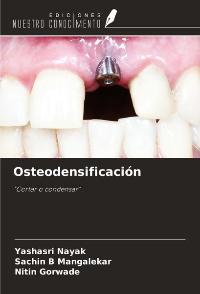 Produktbild: Osteodensificaci&oacute;n