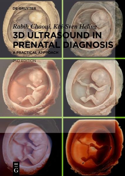 Produktbild: 3D Ultrasound in Prenatal Diagnosis