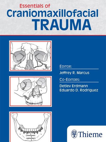 Produktbild: Essentials of Craniomaxillofacial Trauma