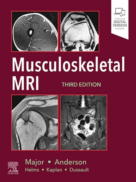 Produktbild: Musculoskeletal MRI E-Book