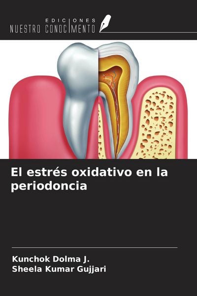 Produktbild: El estr&eacute;s oxidativo en la periodoncia