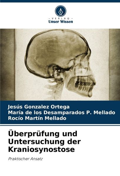 Produktbild: &Uuml;berpr&uuml;fung und Untersuchung der Kraniosynostose