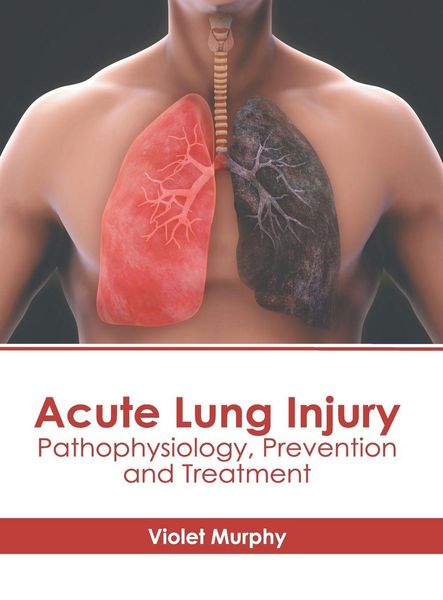 Produktbild: Acute Lung Injury: Pathophysiology, Prevention and Treatment