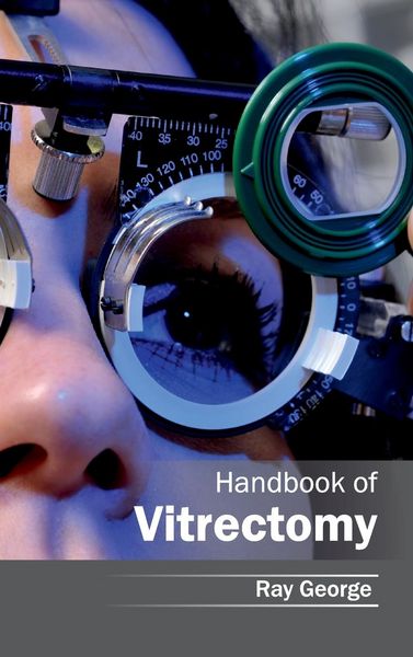 Produktbild: Handbook of Vitrectomy