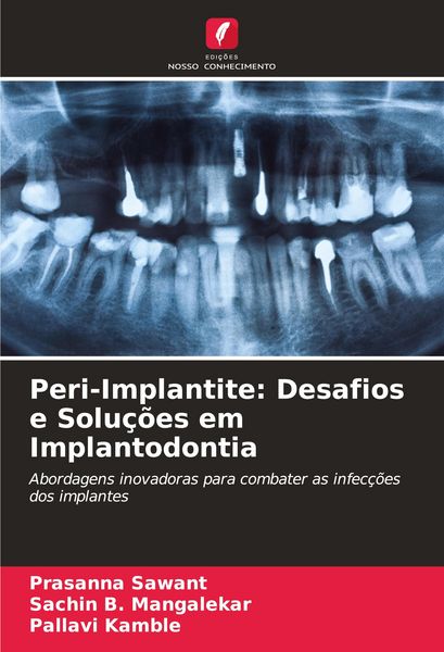 Produktbild: Peri-Implantite: Desafios e Solu&ccedil;&otilde;es em Implantodontia