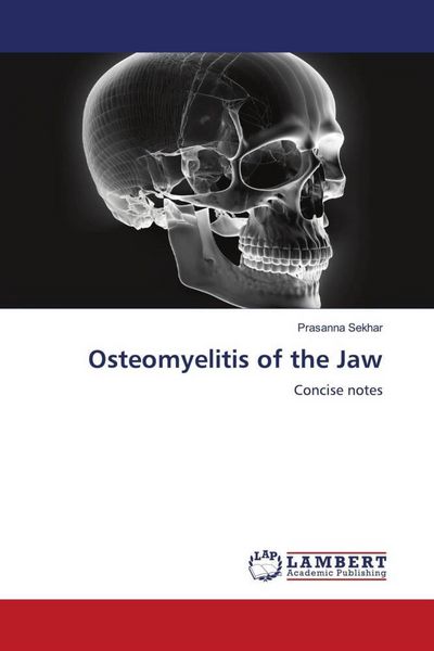 Produktbild: Osteomyelitis of the Jaw