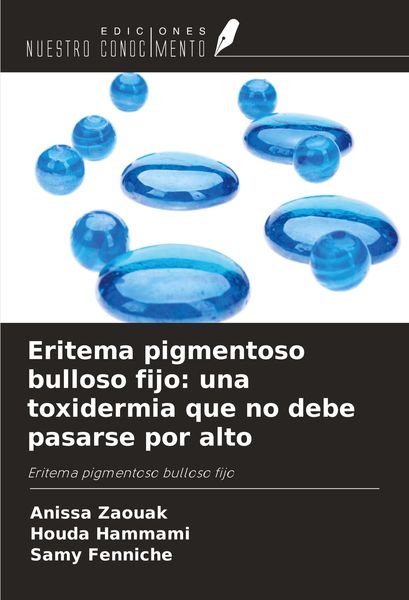 Produktbild: Eritema pigmentoso bulloso fijo: una toxidermia que no debe pasarse por alto