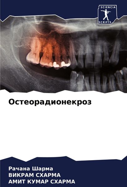 Produktbild: Osteoradionekroz