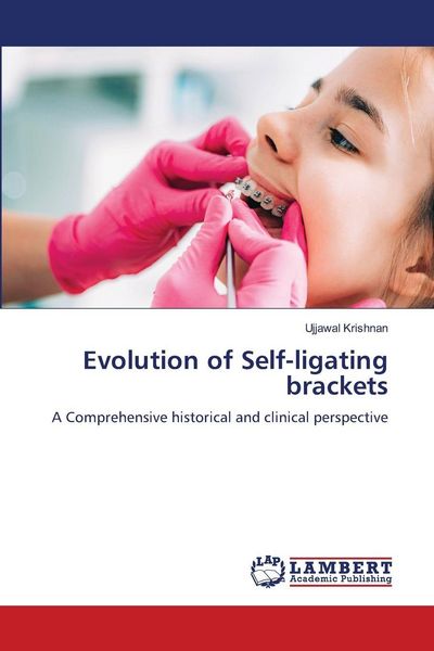 Produktbild: Evolution of Self-ligating brackets